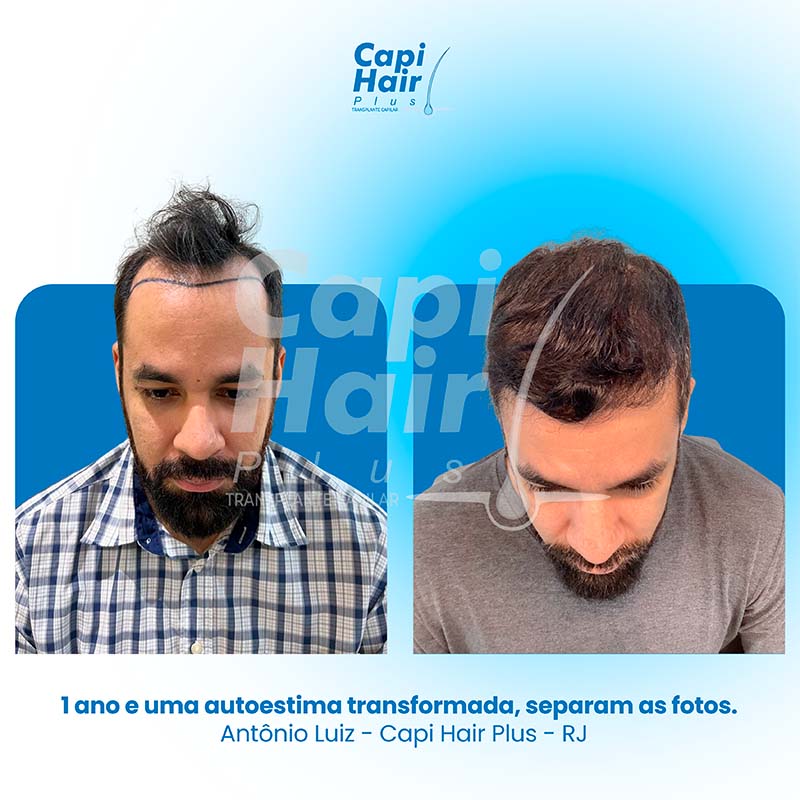 capihair-antes-depois-02