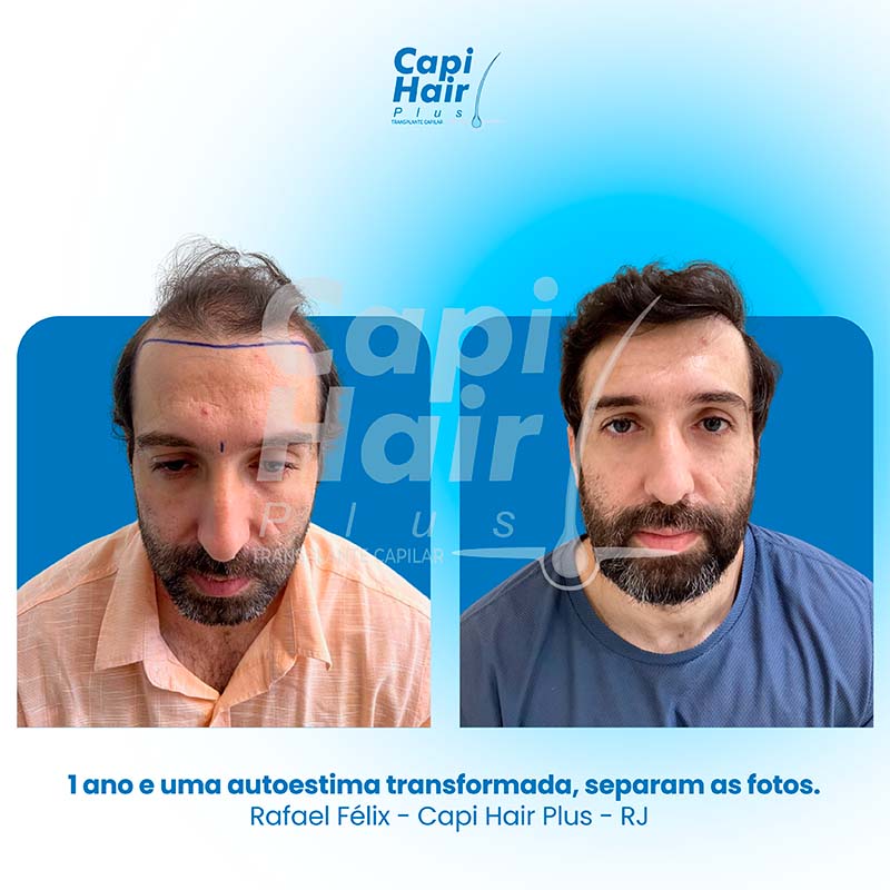 capihair-antes-depois-04