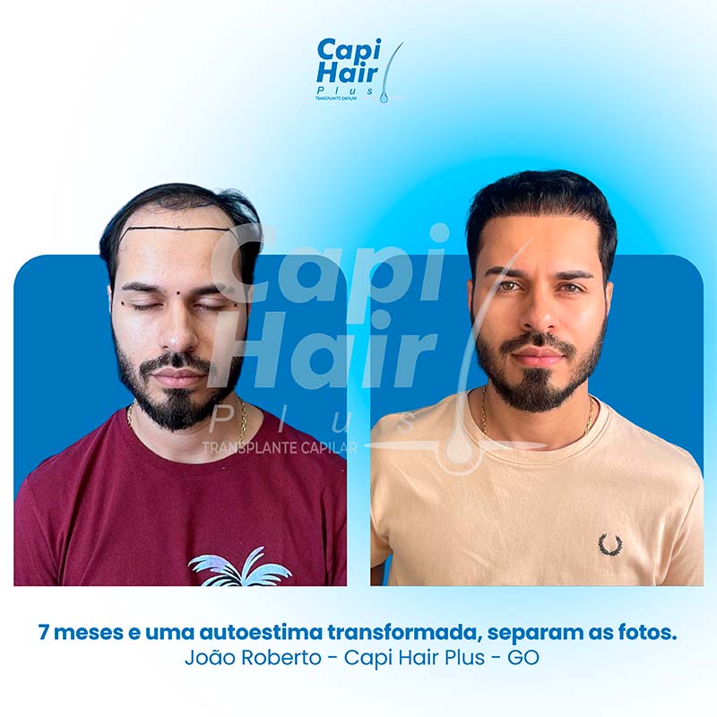 capihair-antes-depois-05