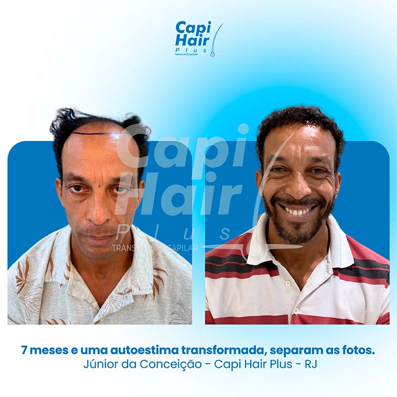 capihair-antes-depois-06