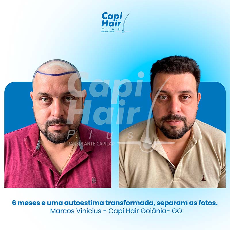 capihair-antes-depois-08